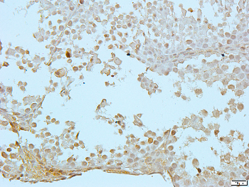 XPO2 Rabbit Polyclonal Antibody