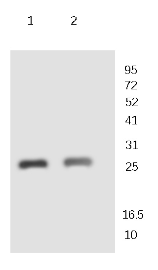 CK2 beta Rabbit Polyclonal Antibody