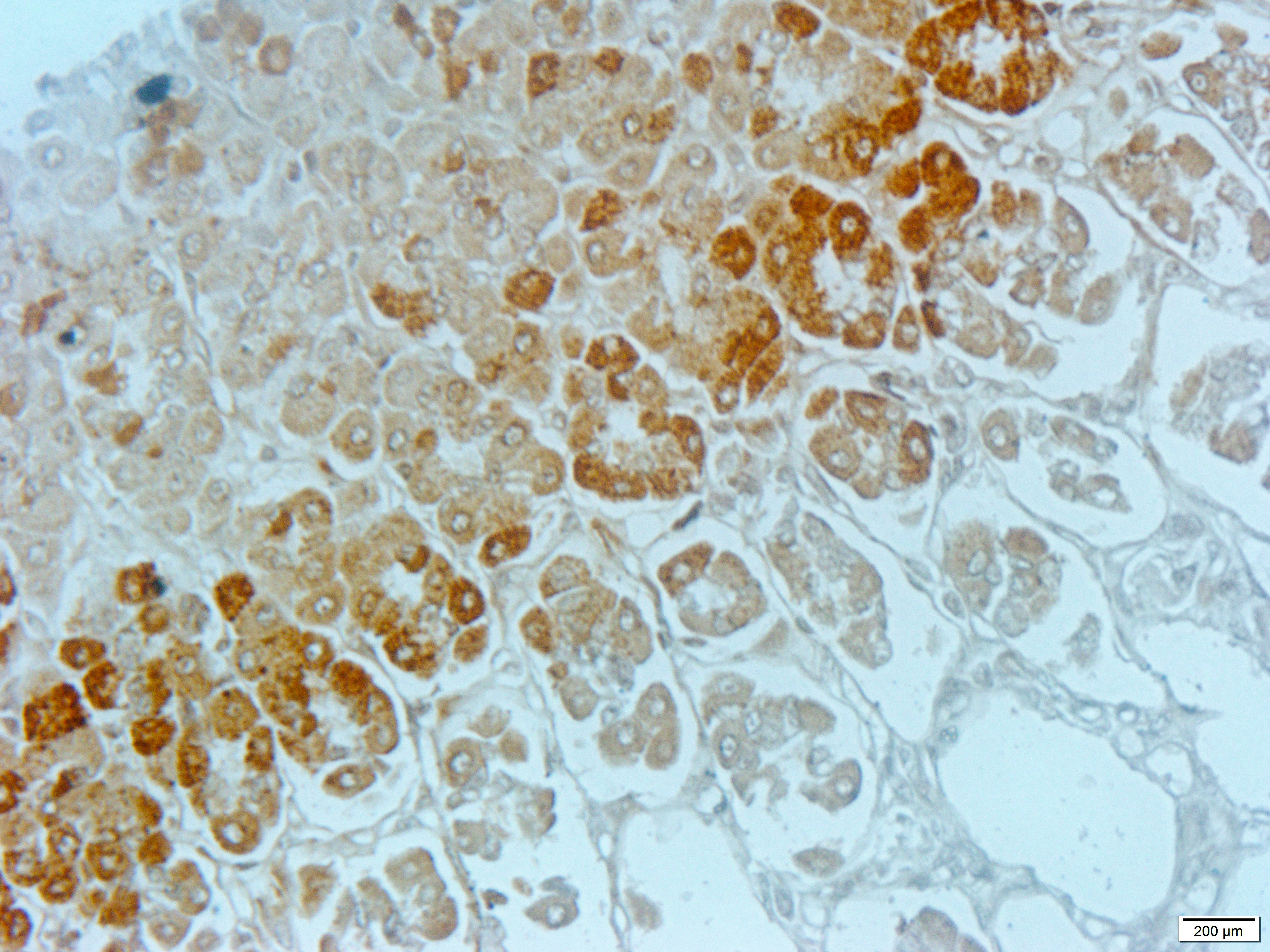 CSRP1 Rabbit Polyclonal Antibody