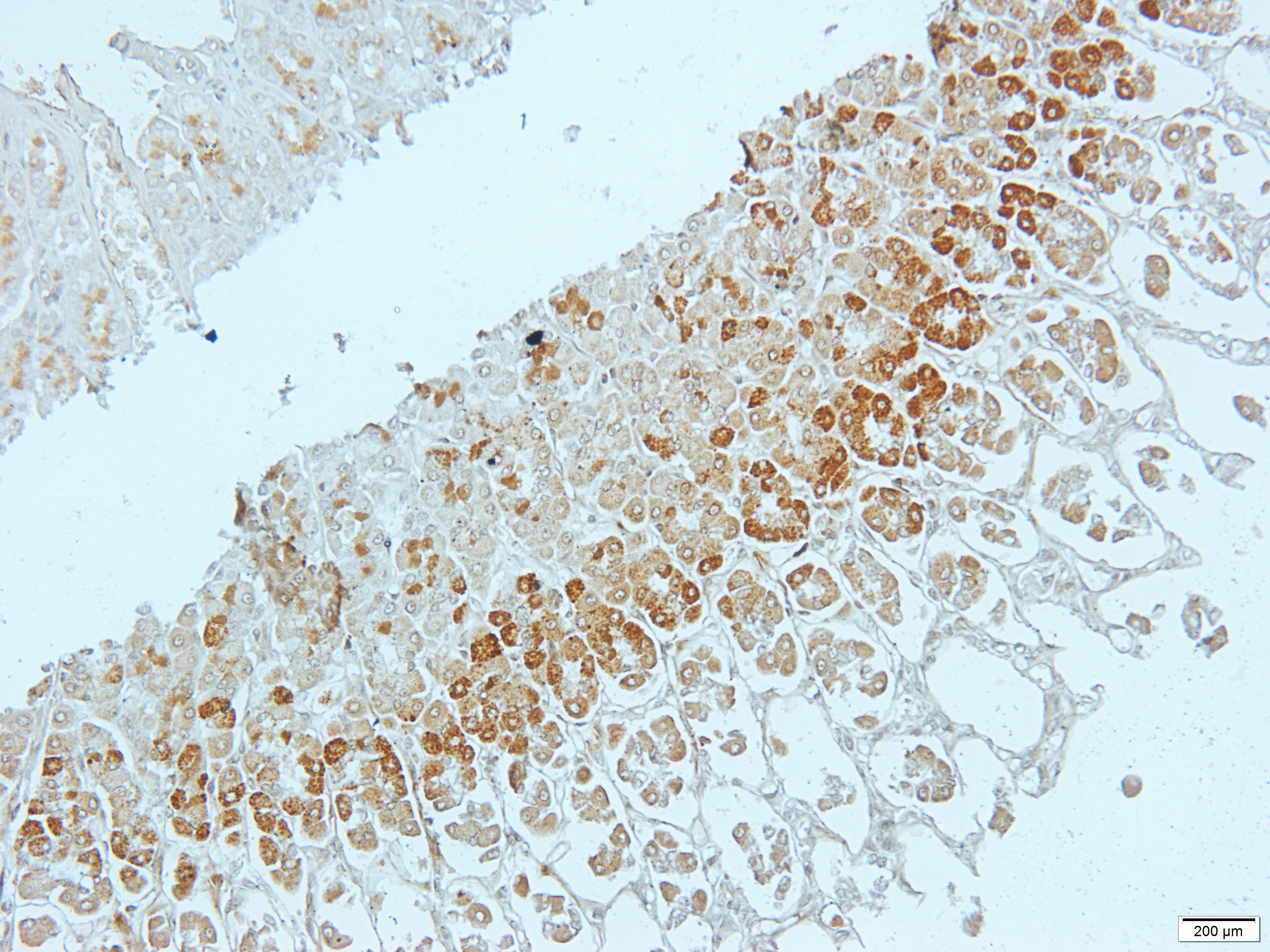 CSRP1 Rabbit Polyclonal Antibody