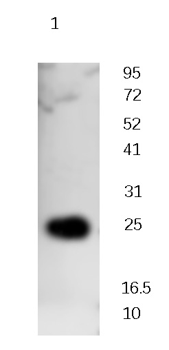 CSRP1 Rabbit Polyclonal Antibody