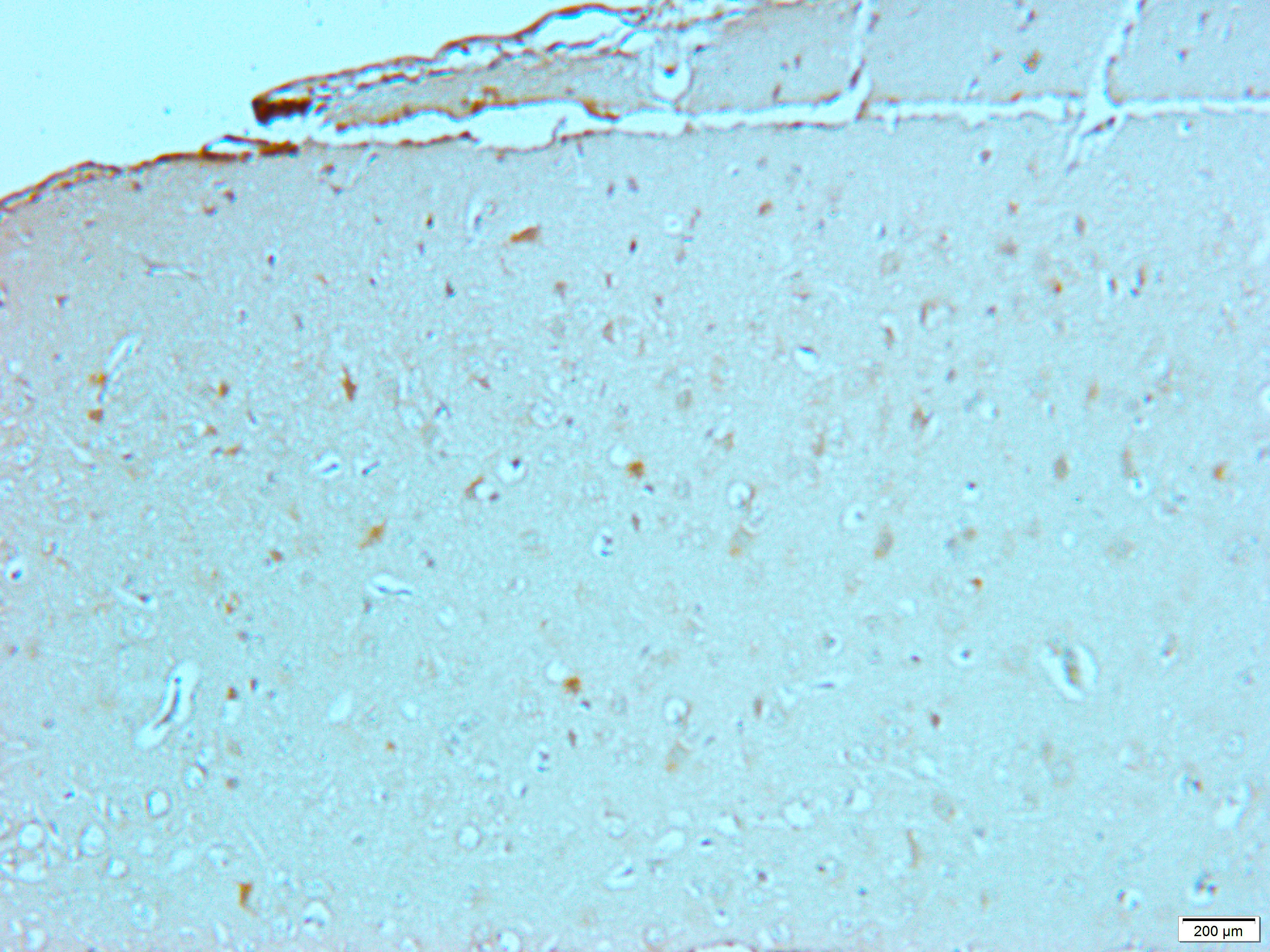 Gamma-enolase Rabbit Polyclonal Antibody
