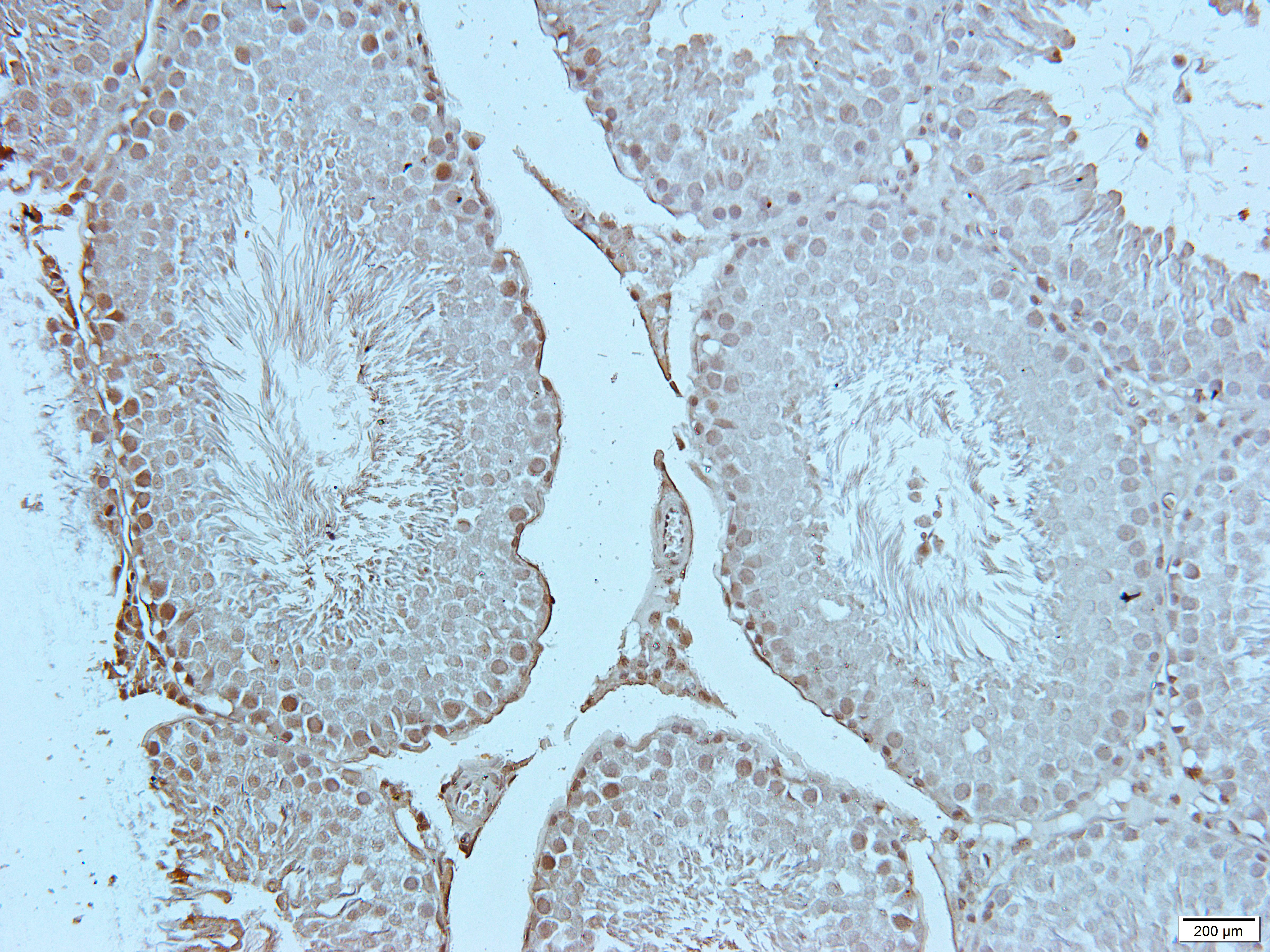 FGFR3 Rabbit Polyclonal Antibody