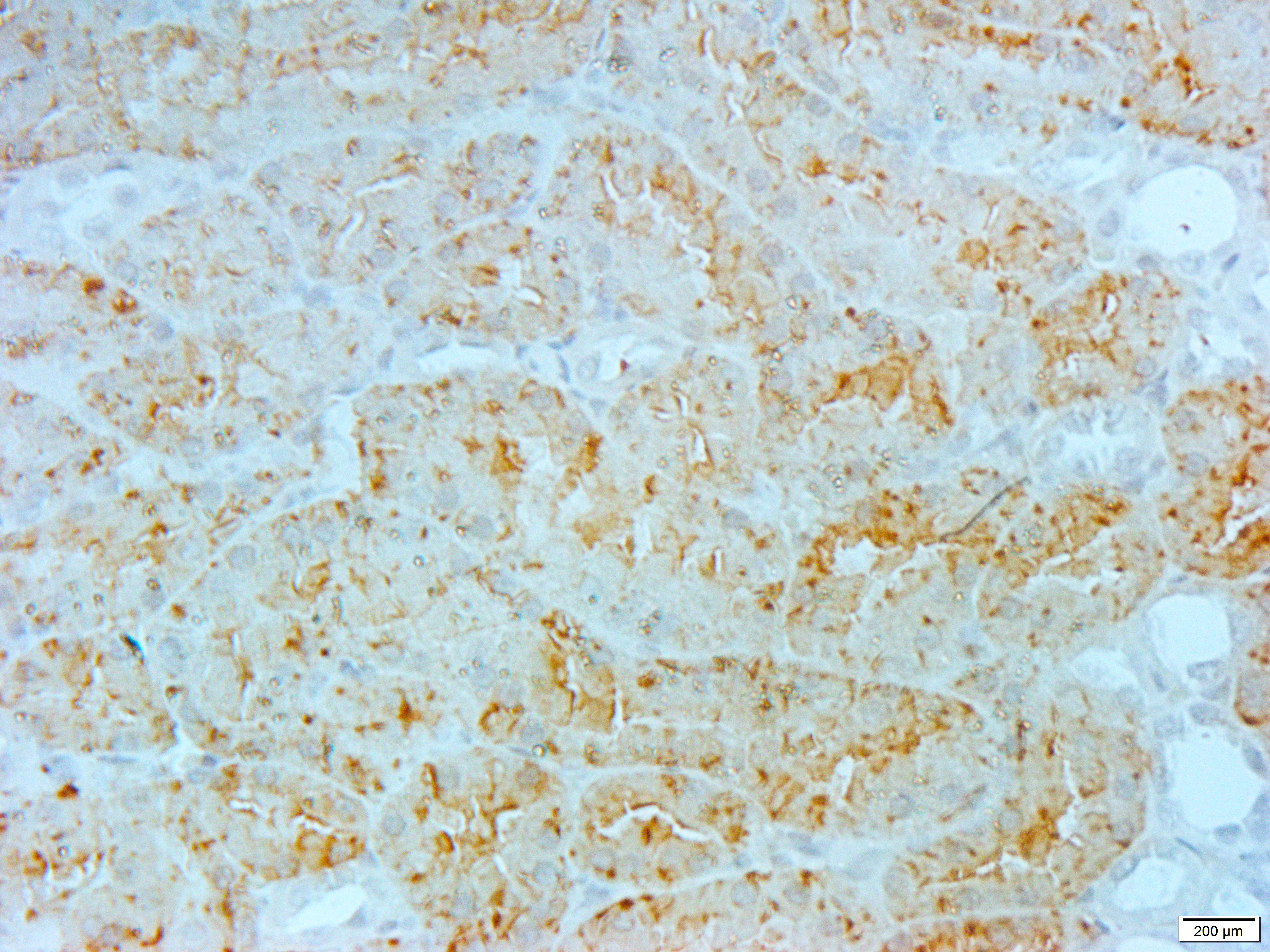 GCLC Rabbit Polyclonal Antibody