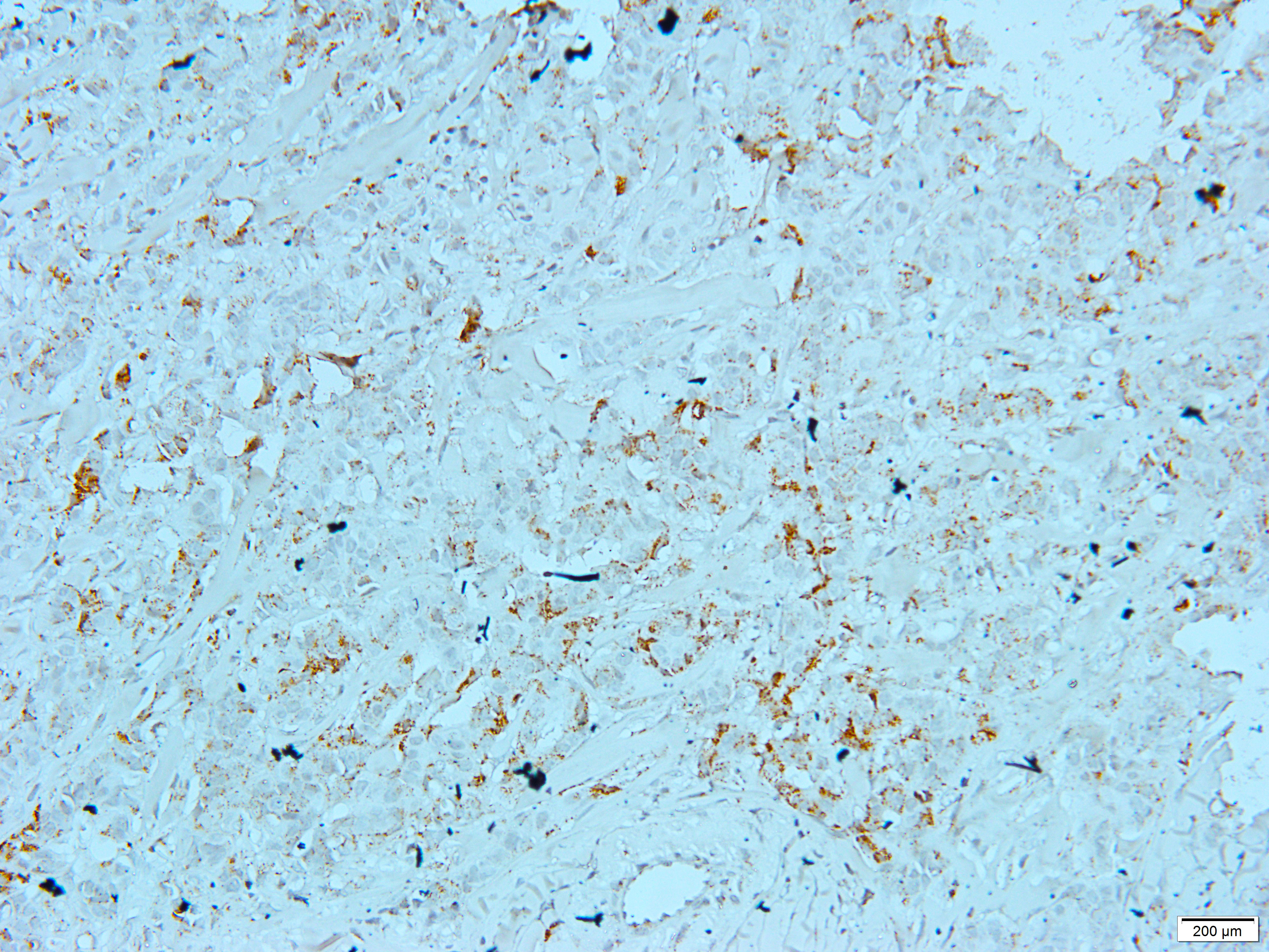 HSP60 Rabbit Polyclonal Antibody