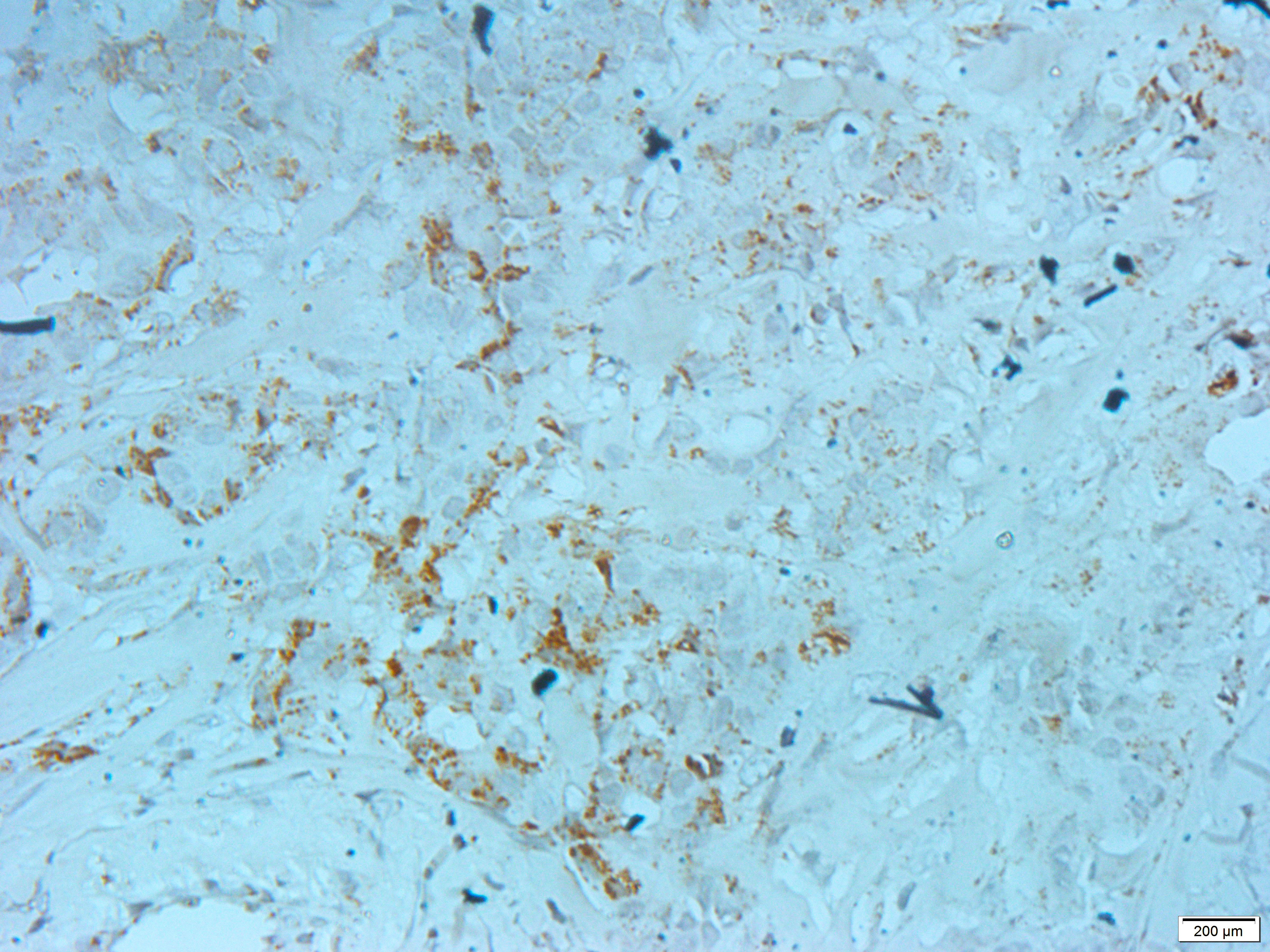 HSP60 Rabbit Polyclonal Antibody