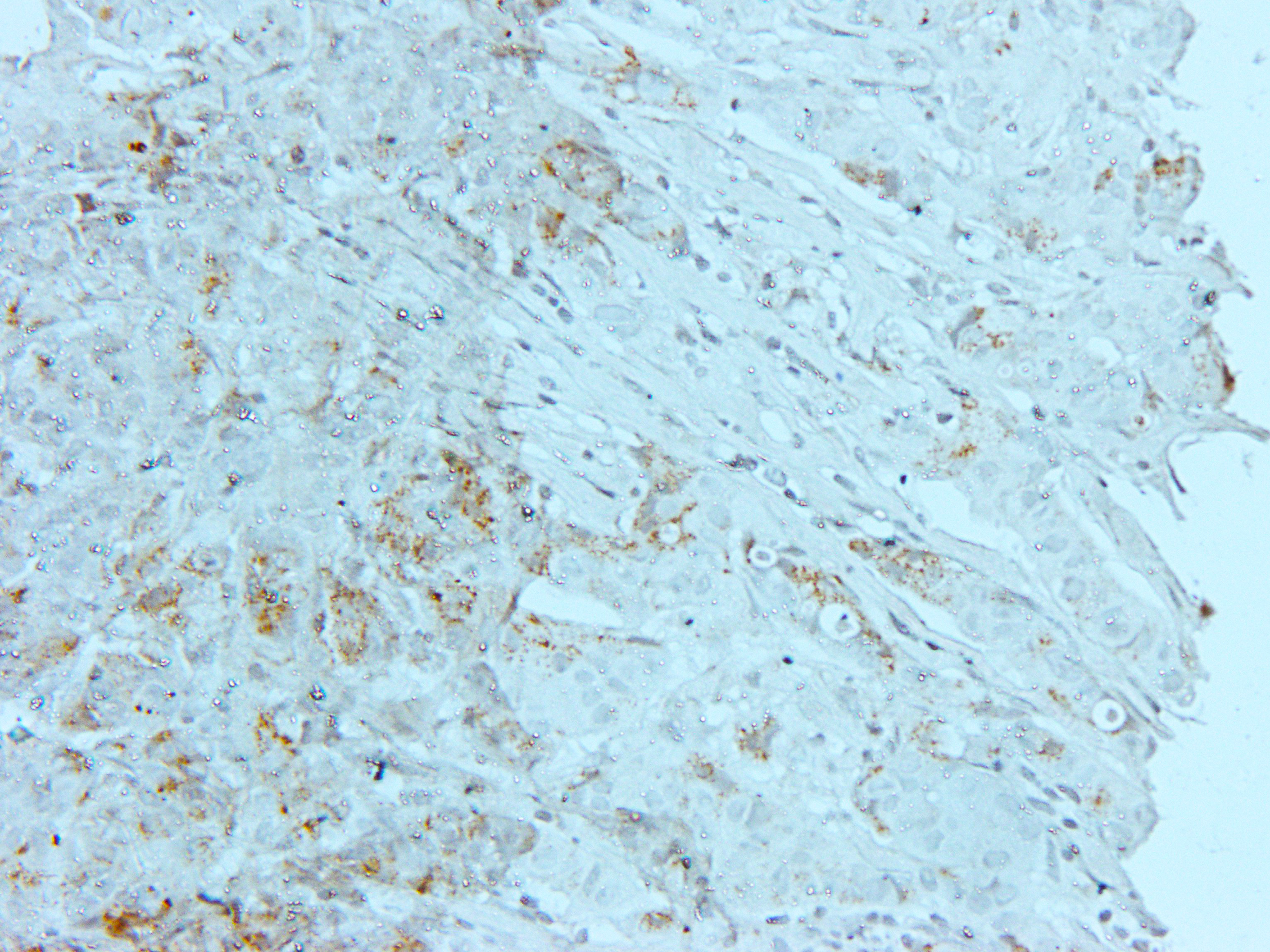 HSPE1 Rabbit Polyclonal Antibody