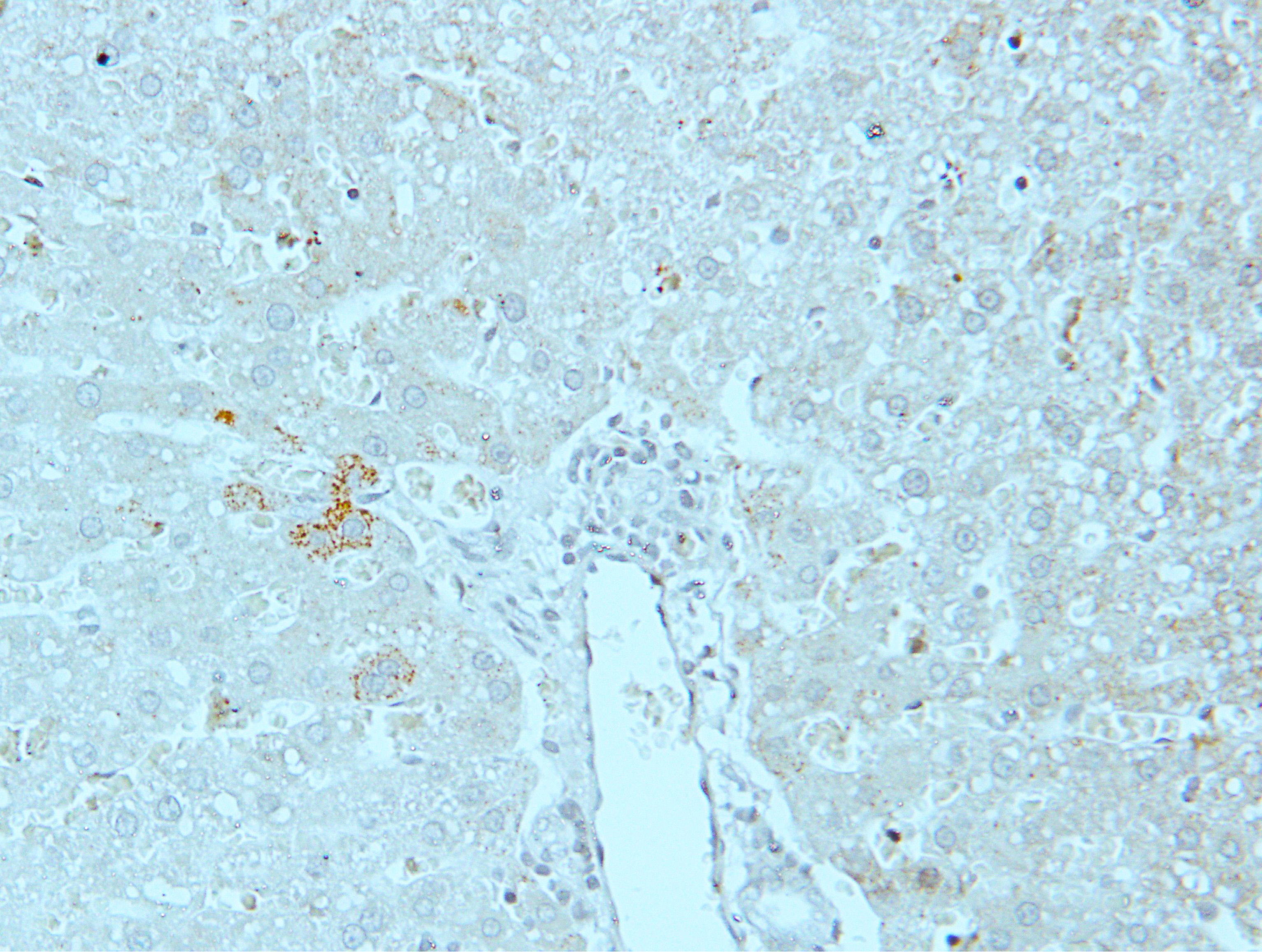 HSPE1 Rabbit Polyclonal Antibody