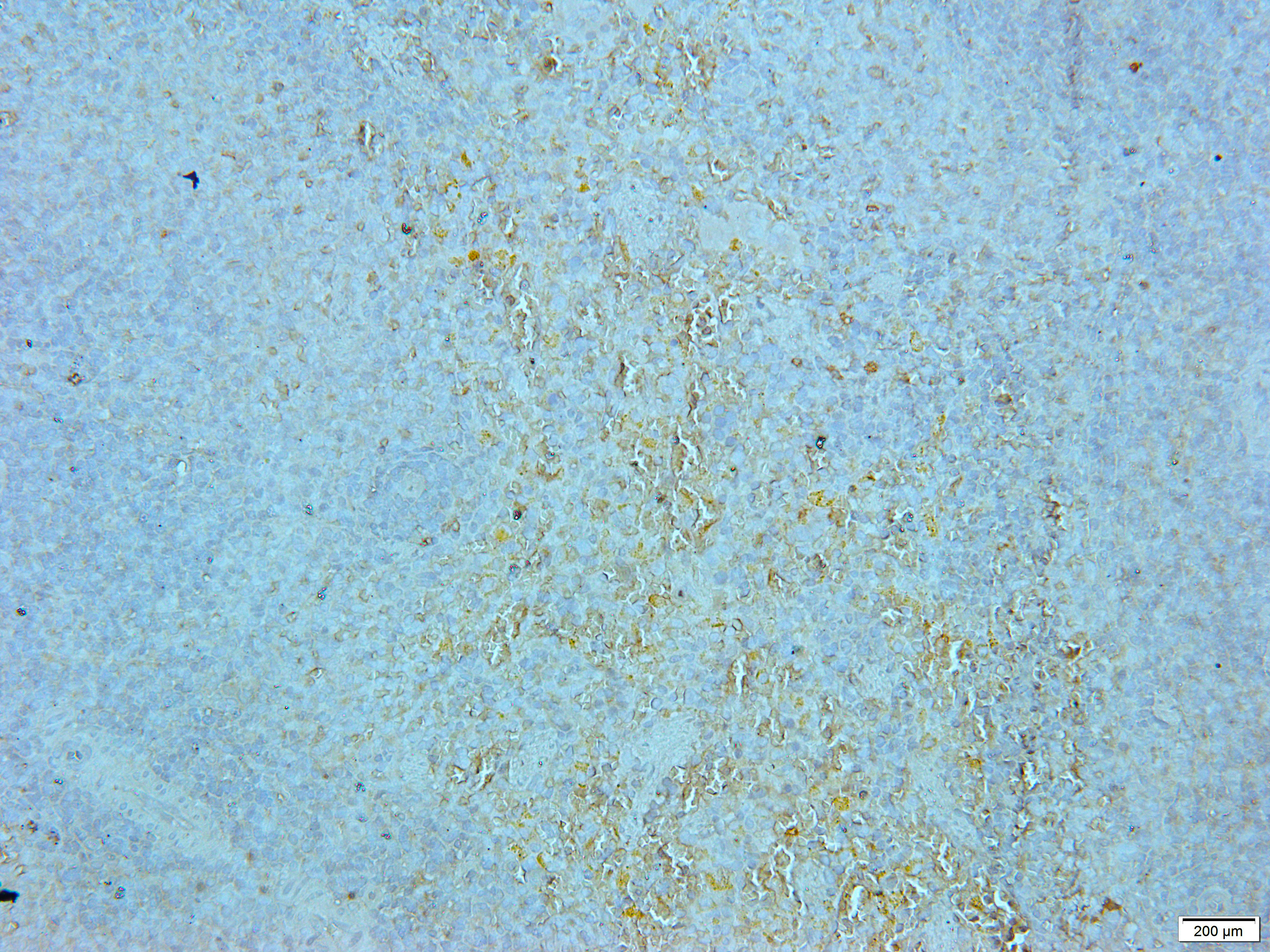 PCNA Rabbit Polyclonal Antibody