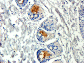 ORM1 Mouse Monoclonal Antibody