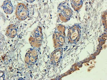 PEDF Mouse Monoclonal Antibody