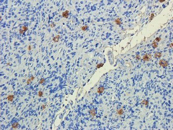 PEDF Mouse Monoclonal Antibody