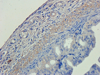 PEDF Mouse Monoclonal Antibody