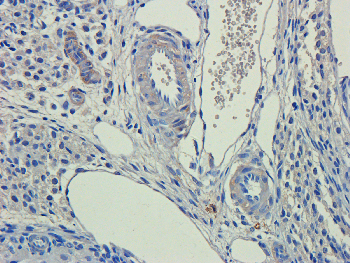 PEDF Mouse Monoclonal Antibody