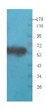 PEDF Mouse Monoclonal Antibody