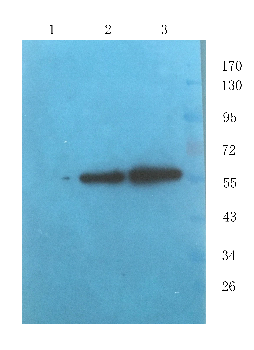 PEDF Mouse Monoclonal Antibody