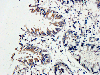 VEGF Mouse Monoclonal Antibody