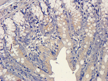 VEGF Mouse Monoclonal Antibody