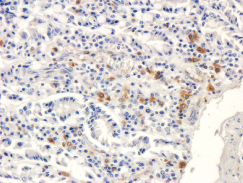 ORM1 Mouse Monoclonal Antibody