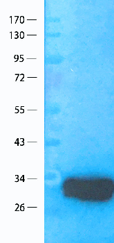 CCL5 Mouse Monoclonal Antibody