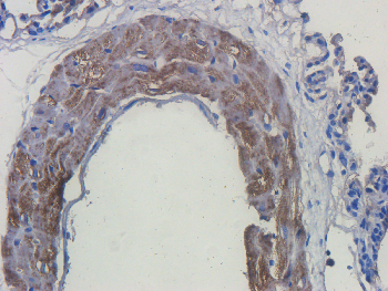 CCL5 Mouse Monoclonal Antibody
