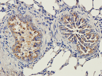 ICAM1 Mouse Monoclonal Antibody