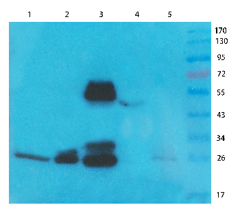 CD8 Mouse Monoclonal Antibody