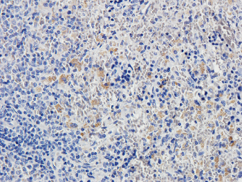 CD8 Mouse Monoclonal Antibody