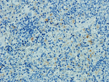 CD8 alpha Mouse Monoclonal Antibody