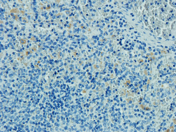 CD8 alpha Mouse Monoclonal Antibody