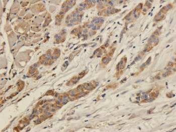 CD8 beta Mouse Monoclonal Antibody