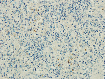 CD8 beta Mouse Monoclonal Antibody