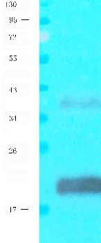 CD8 beta Mouse Monoclonal Antibody