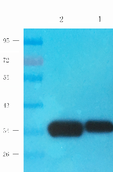 CD163 Mouse Monoclonal Antibody
