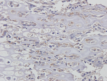 CD163 Mouse Monoclonal Antibody