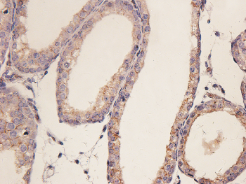 TUBB3 Mouse Monoclonal Antibody