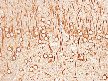 TUBB3 Mouse Monoclonal Antibody
