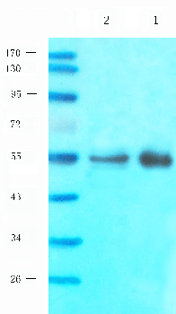 TUBB3 Mouse Monoclonal Antibody