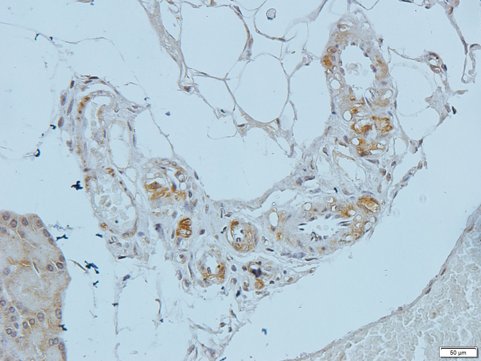 Filaggrin Rabbit Polyclonal Antibody