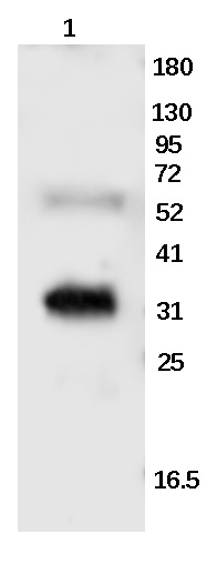 Filaggrin Rabbit Polyclonal Antibody