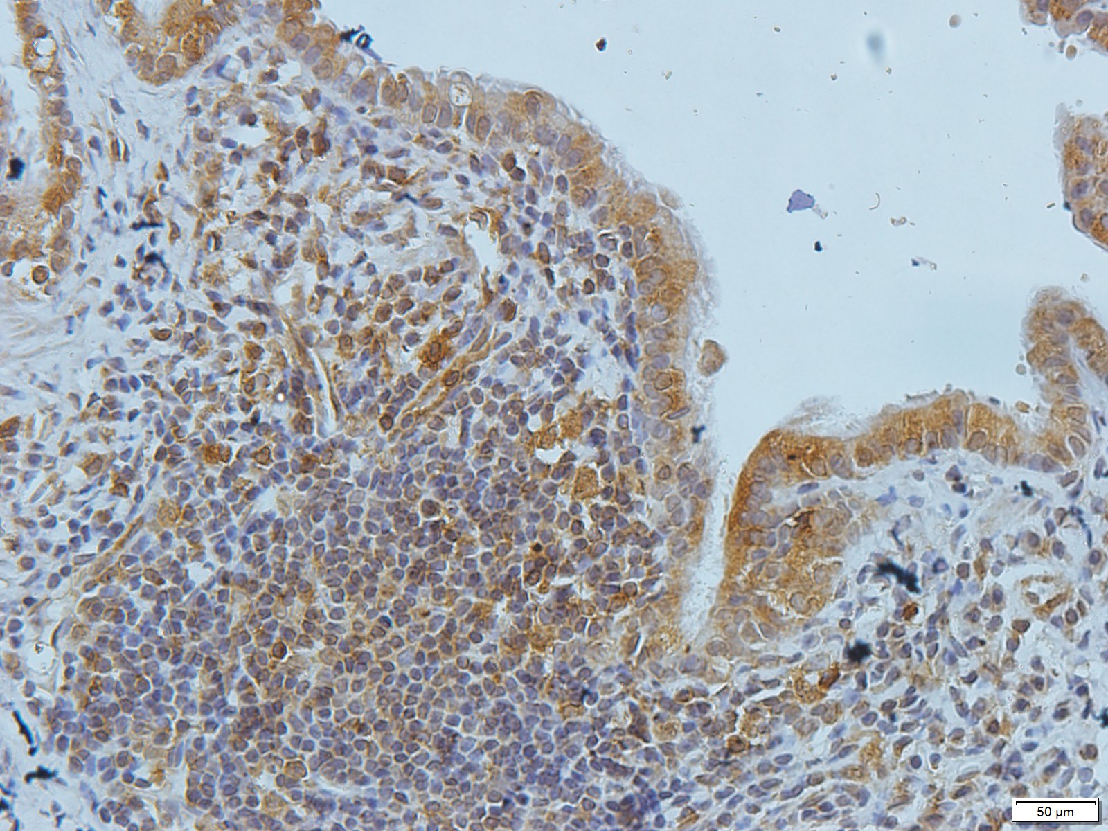 Filaggrin Rabbit Polyclonal Antibody