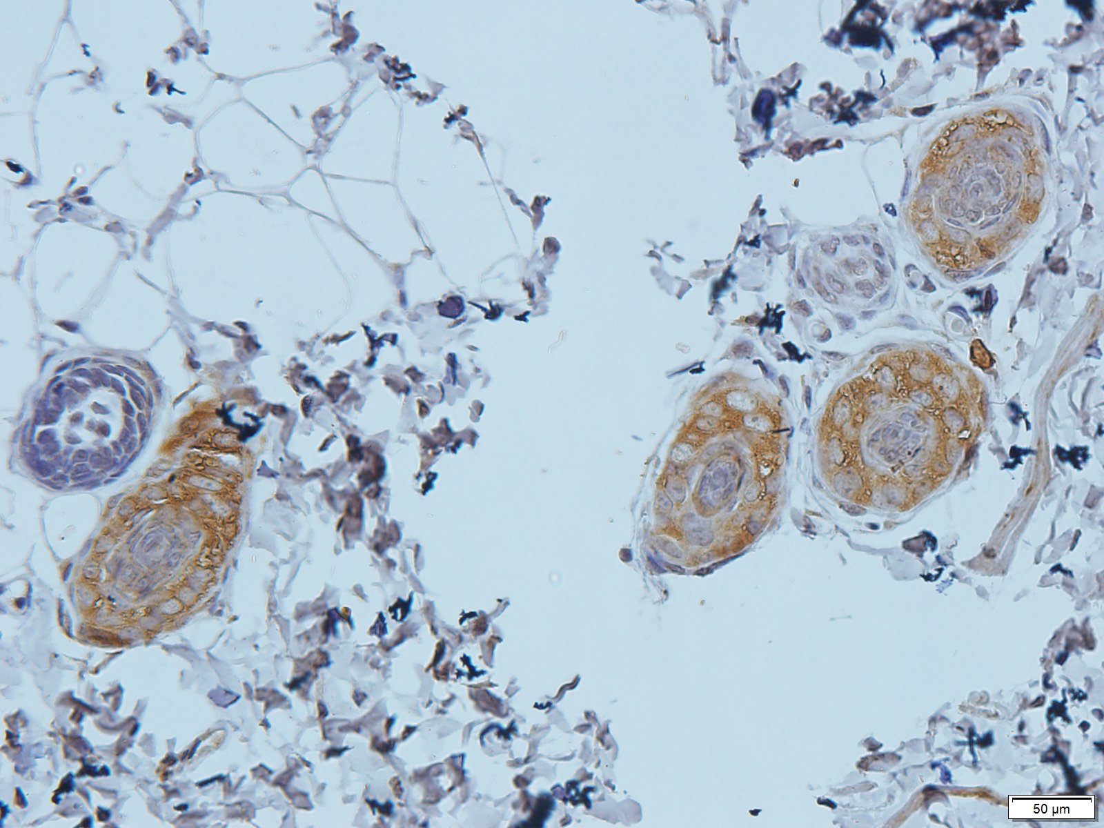 Filaggrin Rabbit Polyclonal Antibody