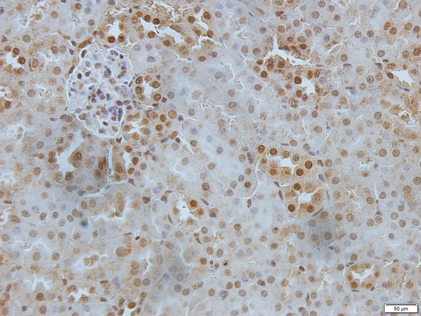 Filaggrin Rabbit Polyclonal Antibody
