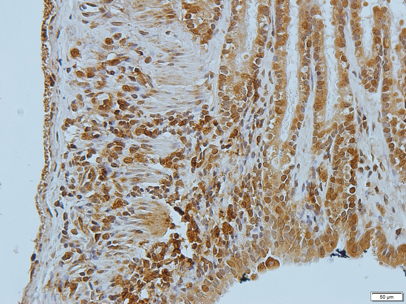 Filaggrin Rabbit Polyclonal Antibody
