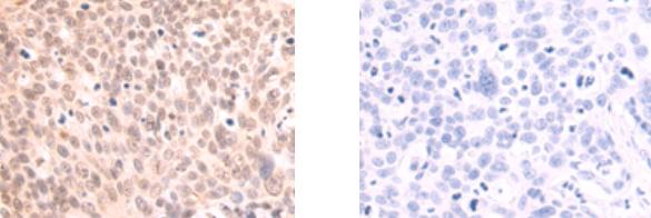 NFKBID Rabbit Polyclonal Antibody