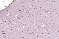 PITX3 polyclonal antibody