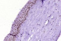 PITX3 polyclonal antibody