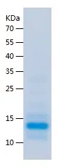 Human ADRA2B Protein, His Tag