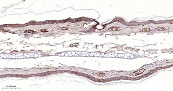 CLDN1 Mouse Monoclonal Antibody