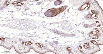 CLDN1 Mouse Monoclonal Antibody